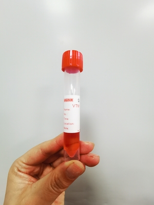 Red Cap 10ml ตัวอย่าง Swab Transport Tube พร้อมสารละลาย 3ml