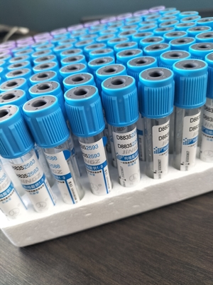 การทดสอบพยาบาลที่กําหนดตามความต้องการ PET Glass Natrium Citrate 3.2% PT Tube 2-10ml Vacuum Blood Collection Tube
