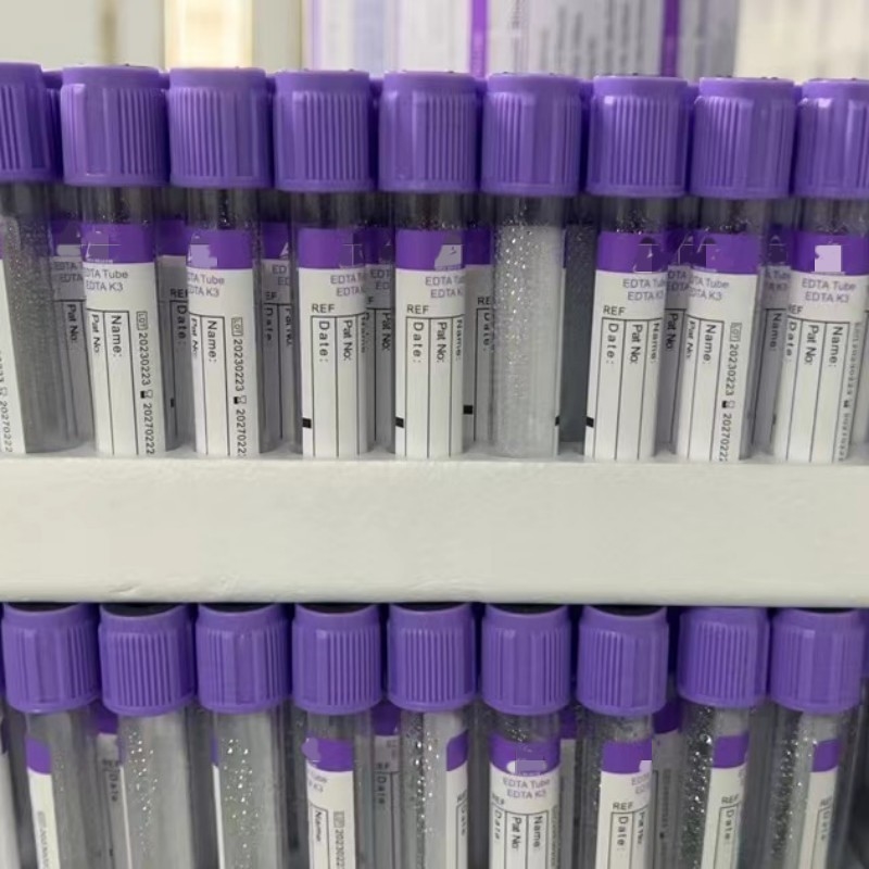 โรงงานหลอดเก็บเลือดของจีน K3 EDTA Vials สำหรับใช้ในห้องปฏิบัติการ